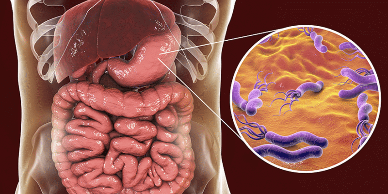 H PYLORI (ULCERS) REMEDY