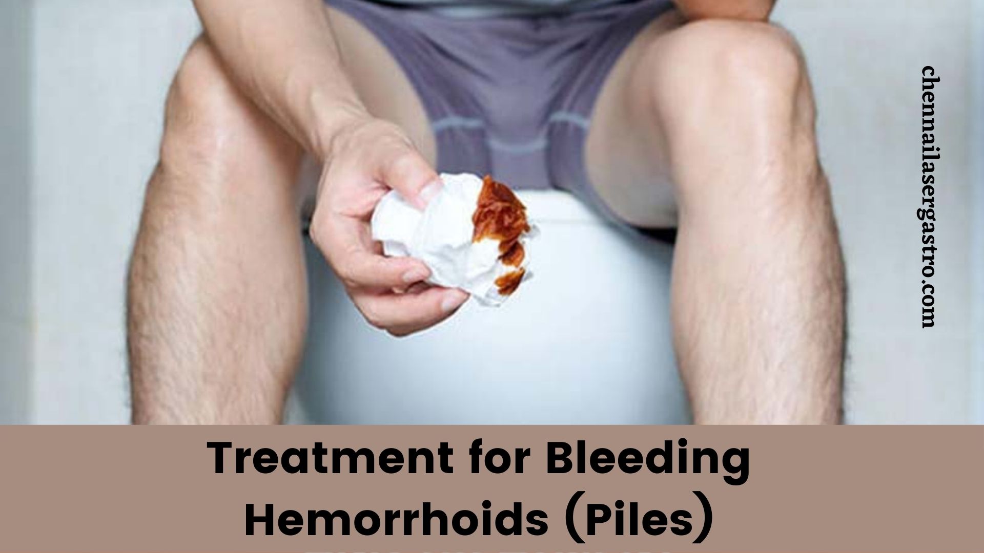 CURE PILES/HAEMORRHIOD/KOOKO NATURALLY